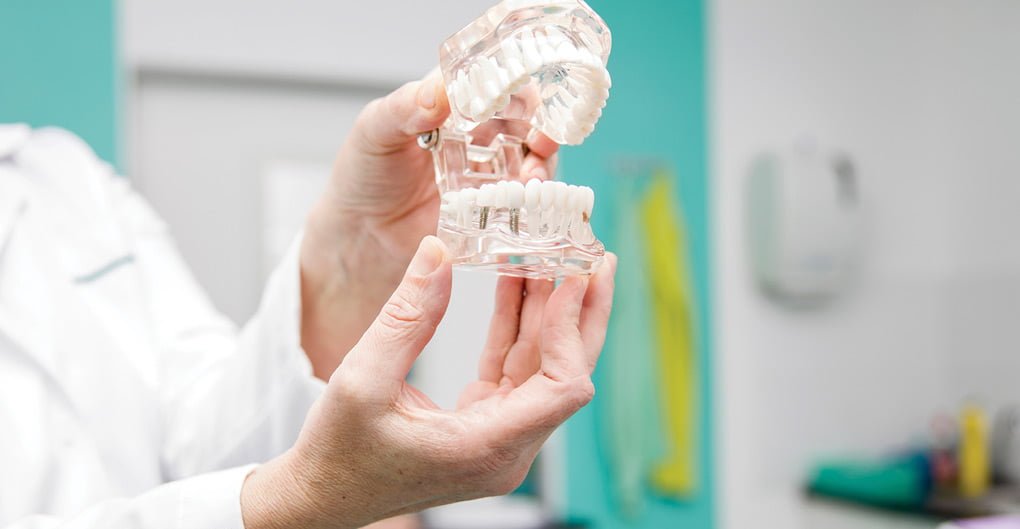 Replace Loose Dentures with Prosthesis On Dental Implants
