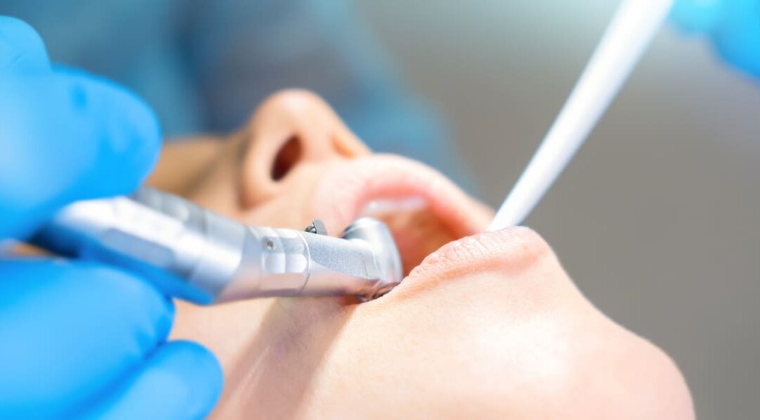 Wisdom Teeth Removal